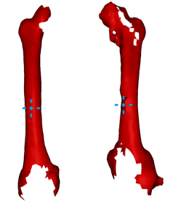 femur_recon-e1690276031135-257x300.png